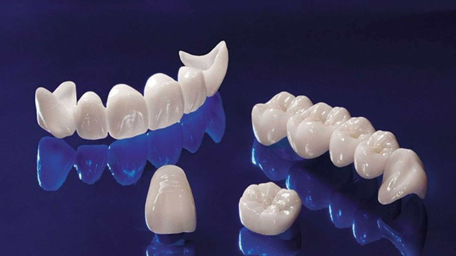 Ceramic Dental Implants