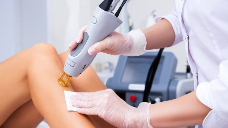 Discomfort During Laser Hair Removal Treatments